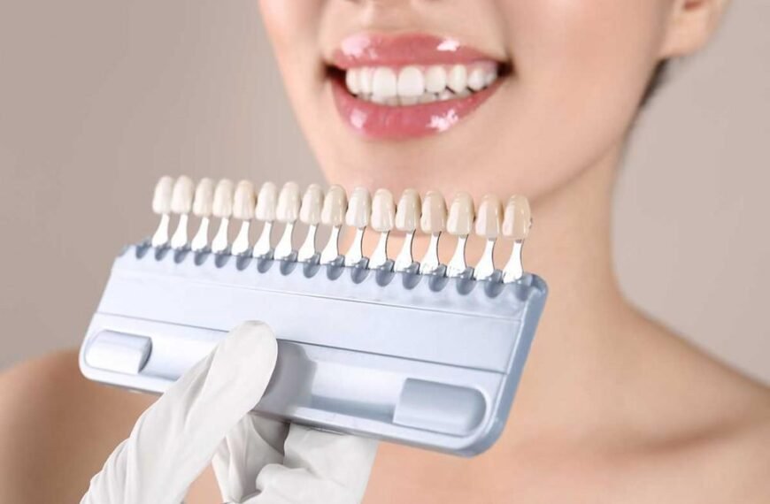 How Veneers Can Transform Your Family’s Smiles At Any Age