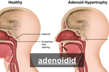 adenoidid