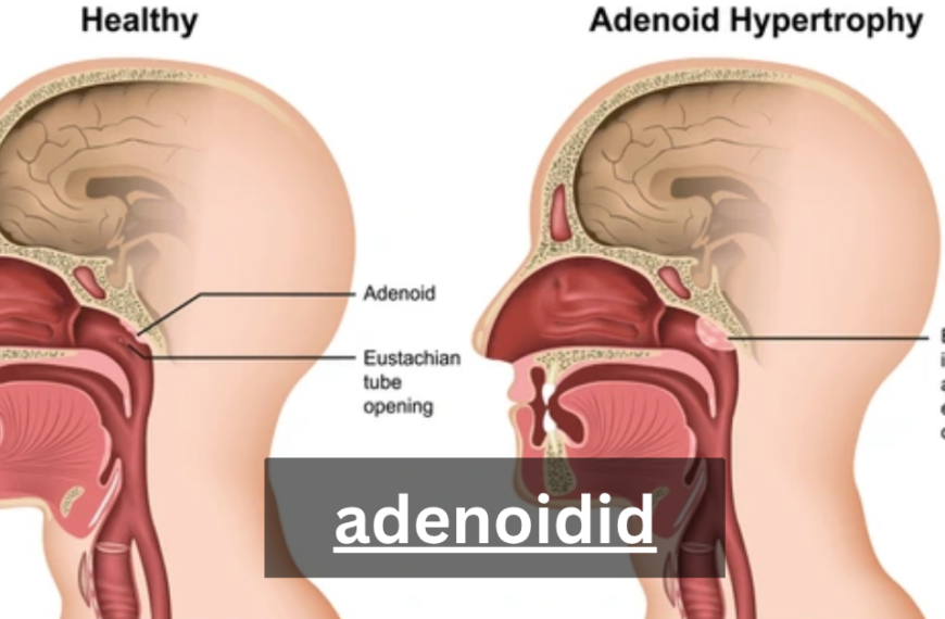 adenoidid